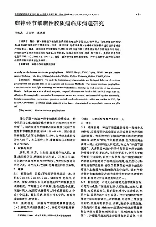 脑神经节细胞性胶质瘤临床病理研究