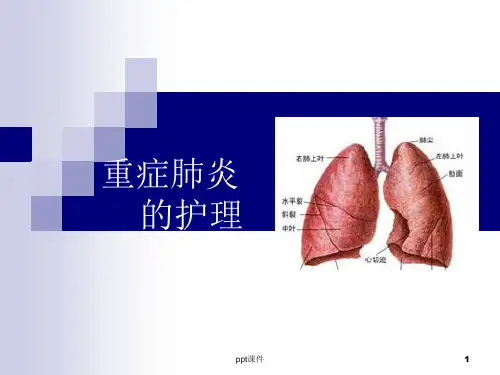 重症肺炎的护理  ppt课件