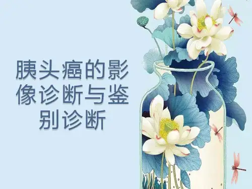 胰头癌的影像诊断与鉴别诊断