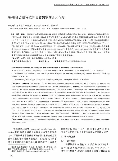 端-端吻合型移植肾动脉狭窄的介入治疗