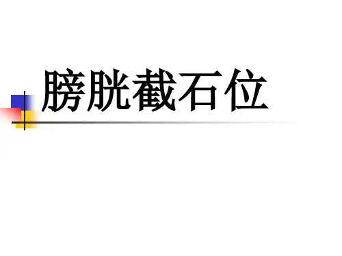 膀胱截石位ppt