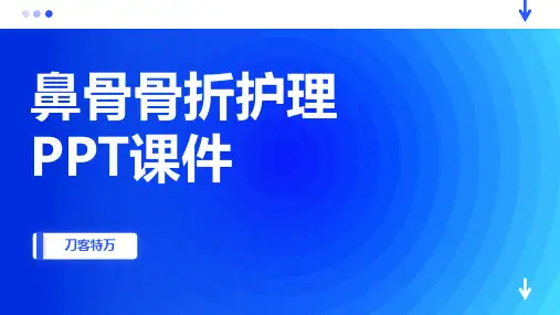 鼻骨骨折护理PPT课件