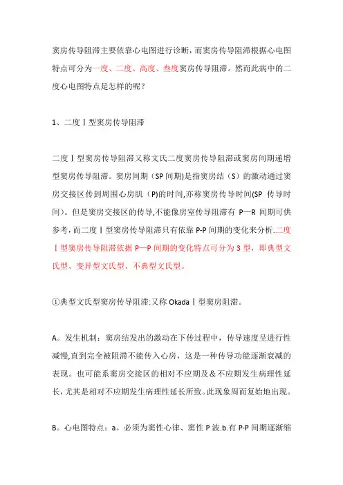 心电图(窦房传导阻滞)