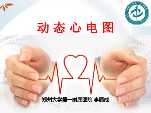 动态心电图