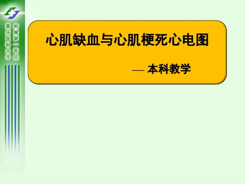 心肌缺血与心肌梗死心电图PPT