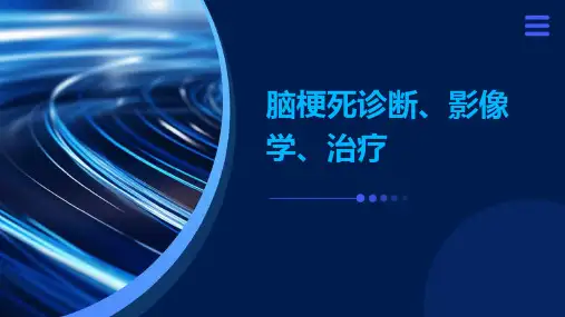 脑梗死诊断、影像学、治疗ppt