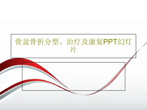 骨盆骨折分型、治疗及康复PPT幻灯片共59页