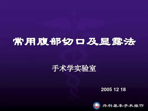 常用腹部切口及显露法