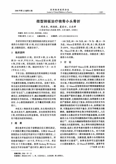 微型钢板治疗桡骨小头骨折