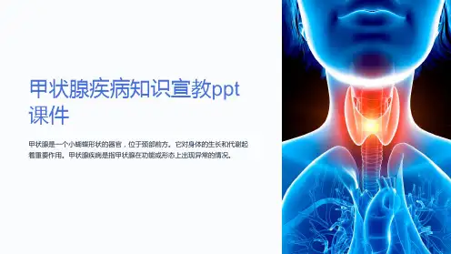 甲状腺疾病知识宣教课件