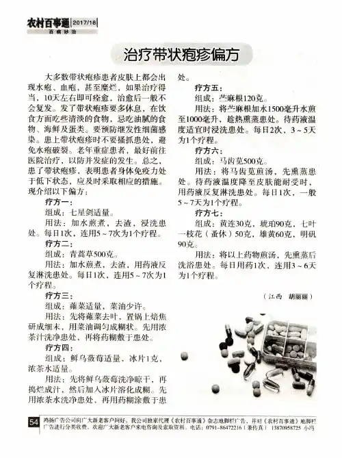 治疗带状疱疹偏方