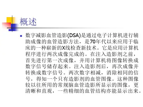 DSA造影操作流程