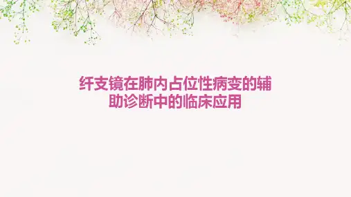 纤支镜在肺内占位性病变的辅助诊断中的临床应用