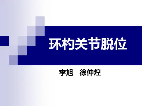 环杓关节脱位