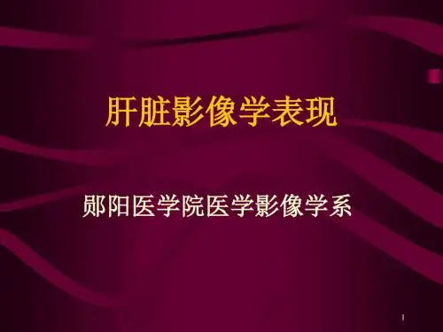 肝脏影像学表现ppt课件