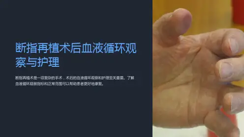 断指再植术后血液循环观察与护理
