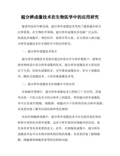 超分辨成像技术在生物医学中的应用研究