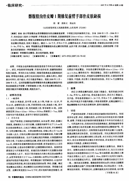 髂腹股沟骨皮瓣Ⅰ期修复前臂手部骨皮肤缺损