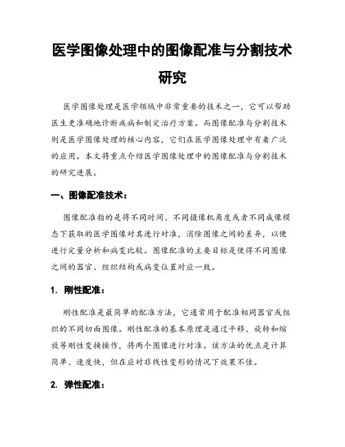 医学图像处理中的图像配准与分割技术研究