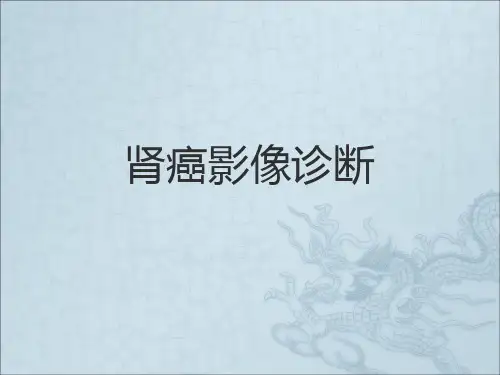 肾癌影像诊断