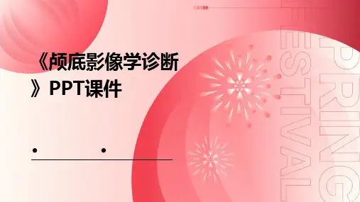 《颅底影像学诊断》课件