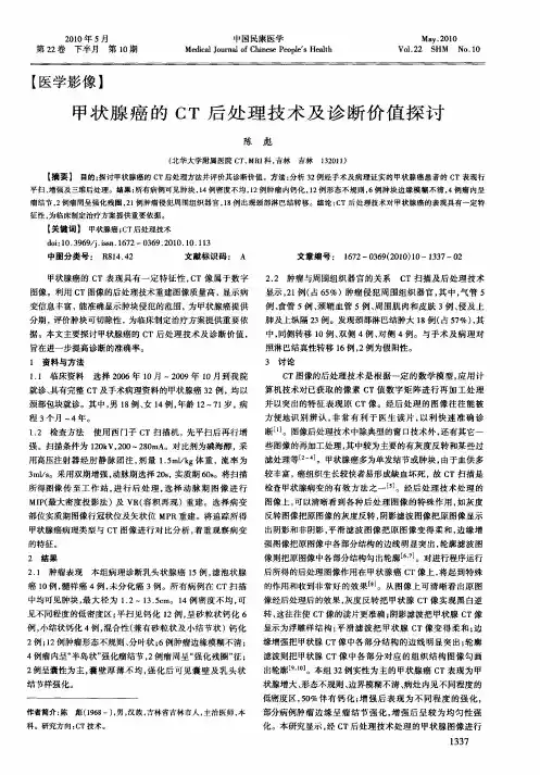 甲状腺癌的CT后处理技术及诊断价值探讨