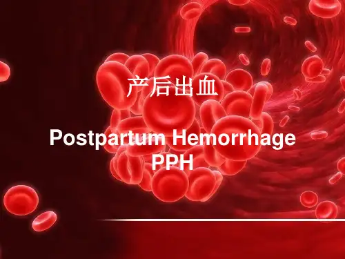 妇产科学产后出血PPT课件