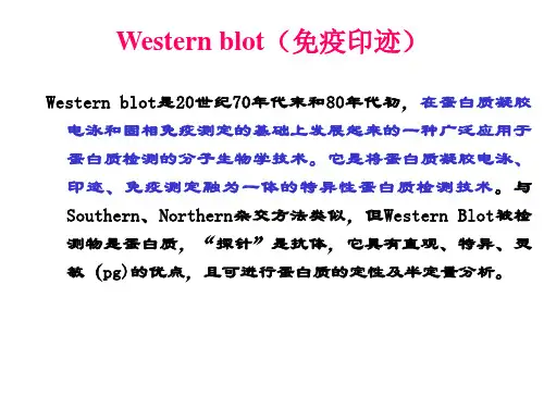 Western blot实验步骤