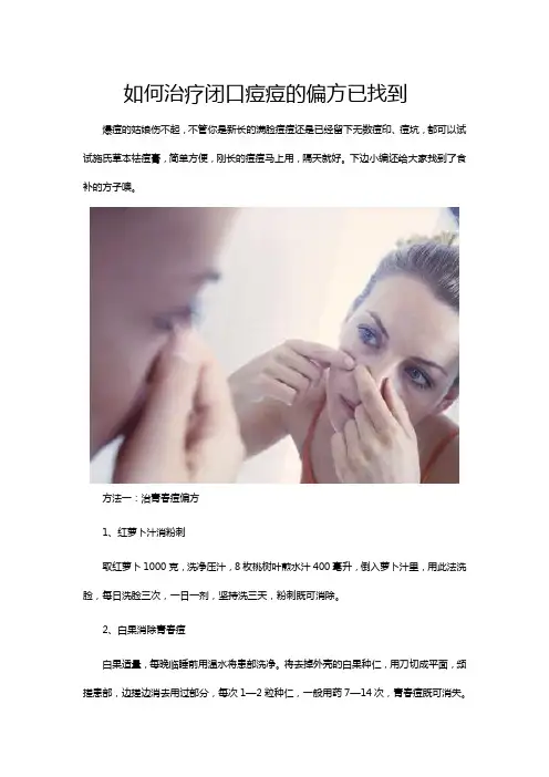 如何治疗闭口痘痘的偏方已找到