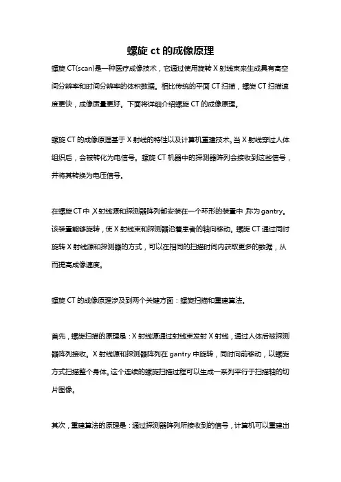 螺旋ct的成像原理
