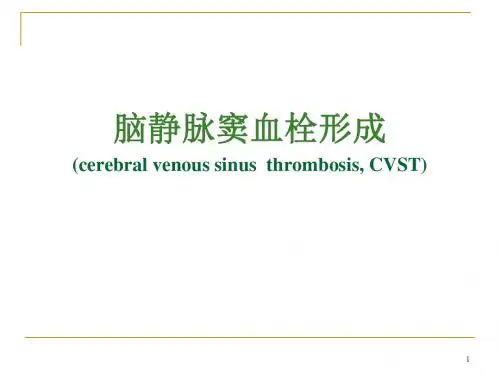 脑静脉窦血栓PPT课件