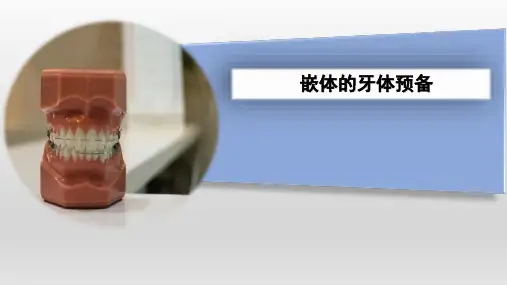 《口腔医学技术》课件——嵌体的牙体预备
