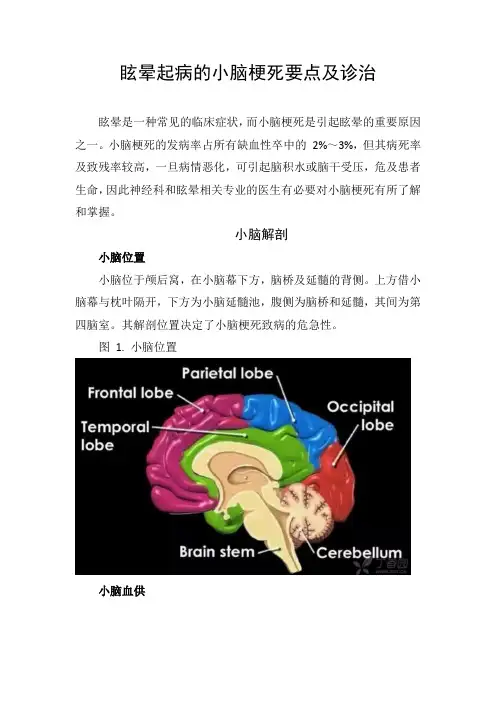 眩晕起病小脑梗死要点及诊治