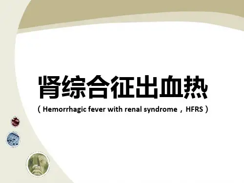 肾综合征出血热