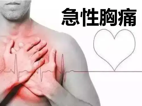 《急性胸痛》ppt课件40页PPT