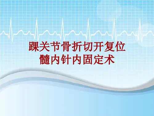手术讲解模板：踝关节骨折切开复位髓内针内固定术
