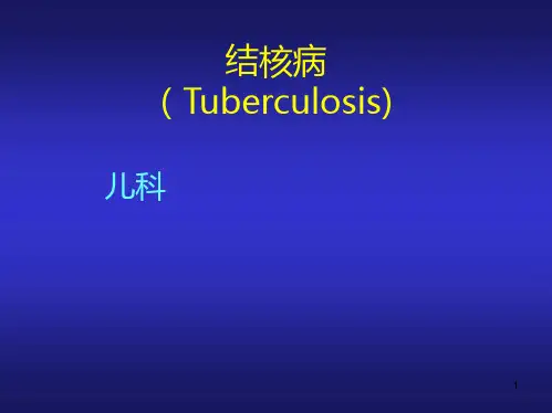 结核病ppt课件