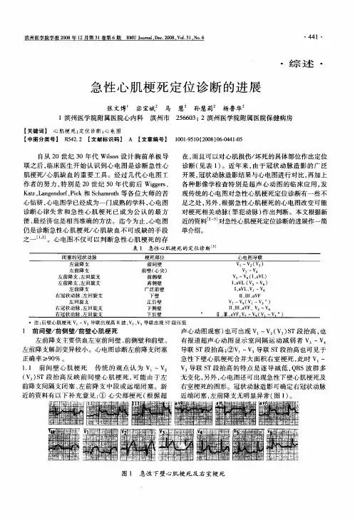 急性心肌梗死定位诊断的进展