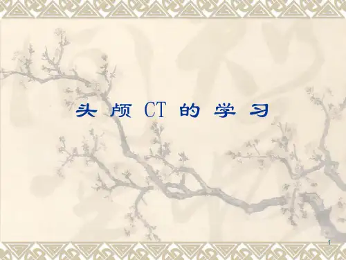 头颅CT与断层解剖对照ppt课件