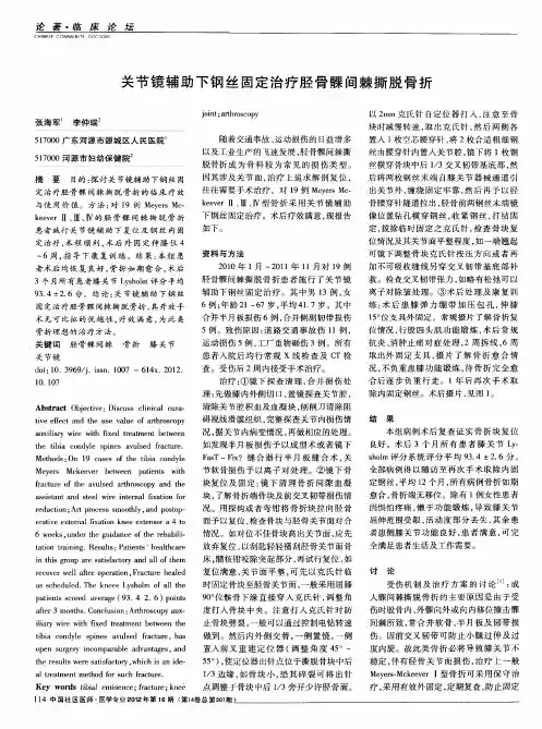 关节镜辅助下钢丝固定治疗胫骨髁间棘撕脱骨折