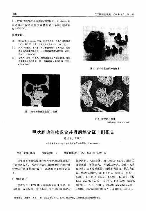 甲状腺功能减退合并肾病综合征1例报告