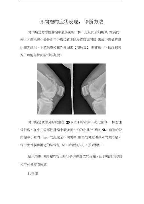 骨肉瘤的症状表现-诊断方法