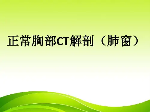 正常胸部CT解剖(肺窗)