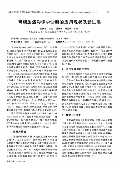 肾细胞癌影像学诊断的应用现状及新进展