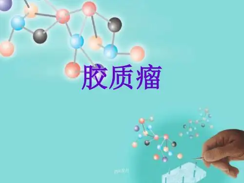 胶质瘤  ppt课件