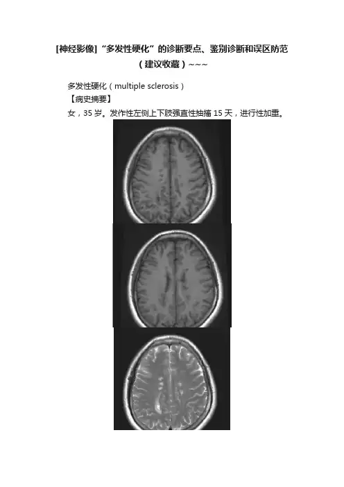 [神经影像]“多发性硬化”的诊断要点、鉴别诊断和误区防范（建议收藏）~~~