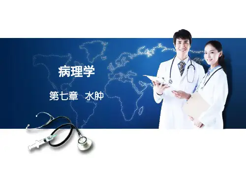 护理学《病理学》第七章    水 肿