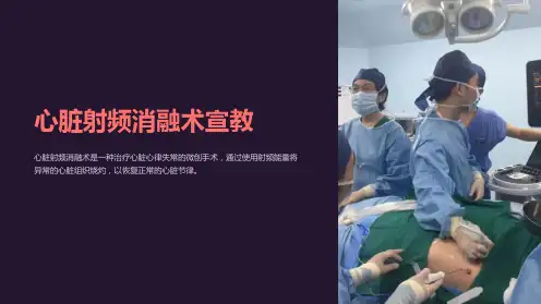 心脏射频消融术宣教