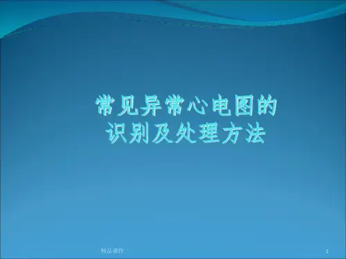 常见异常心电图的识别及处理ppt课件