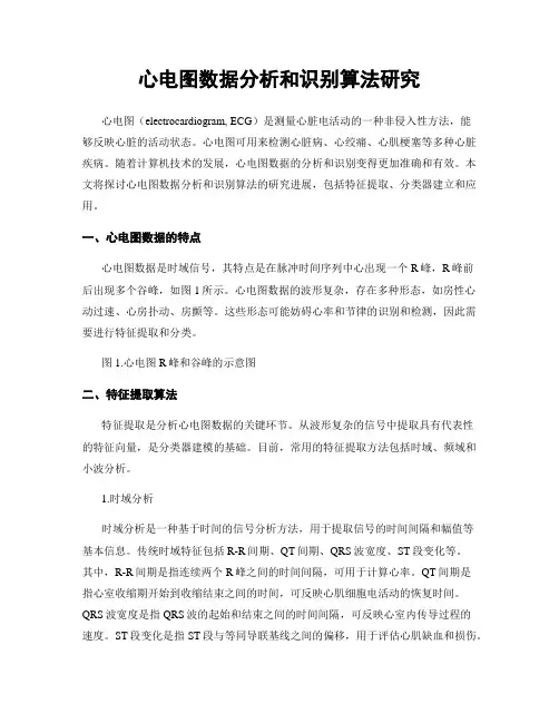 心电图数据分析和识别算法研究